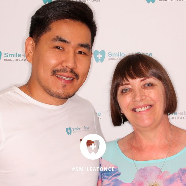 Селфи после имплантации верхней челюсти