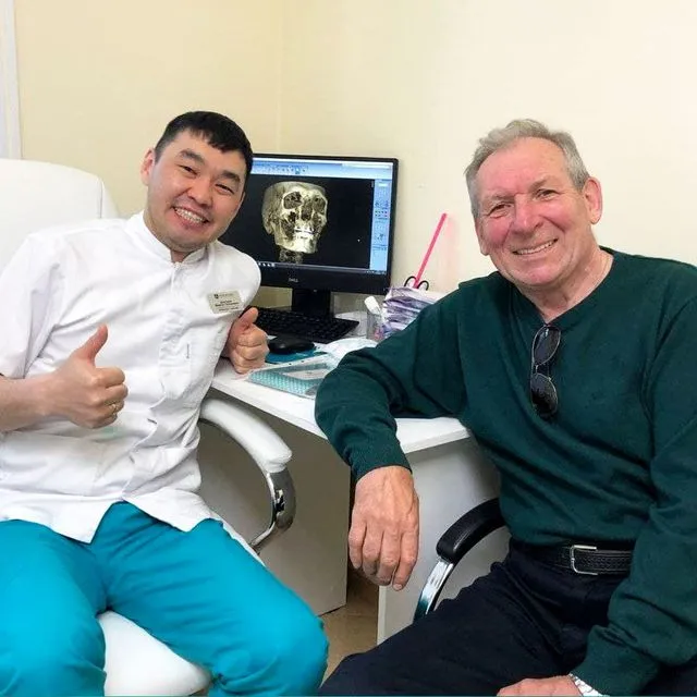 Через 8 месяцев после имплантации верхней челюсти