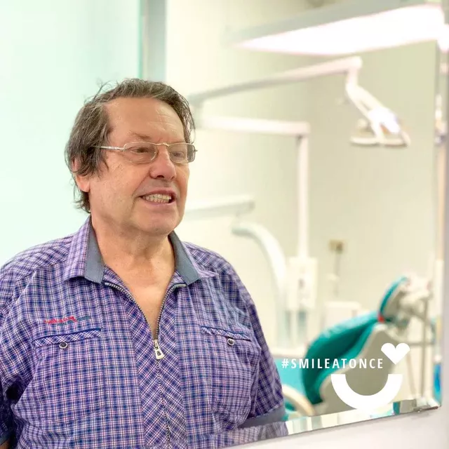 Фото пациента после комплексной имплантации на верхней и нижней челюстях