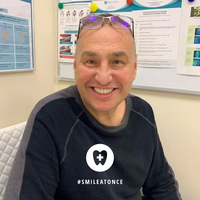 Селфи после имплантации за 3 дня