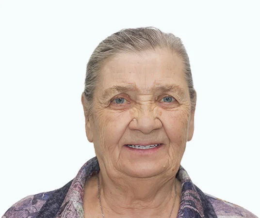 Фото после имплантации зубов