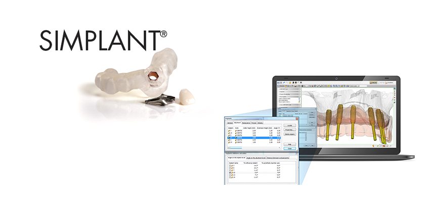 Simplant: новая эра цифровой имплантологии
