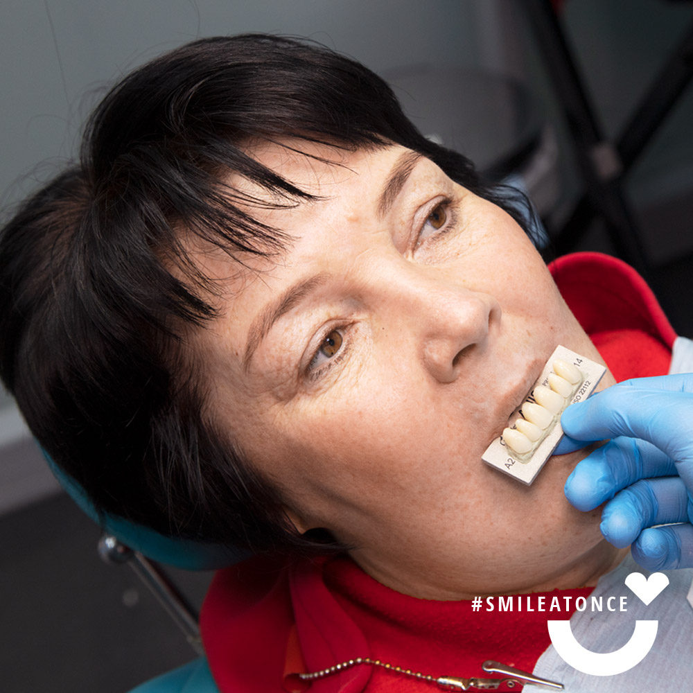 Выбор цвета коронок зубов