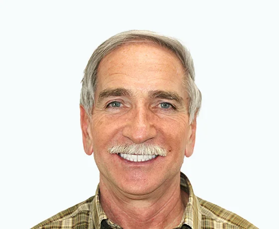 Фото после имплантации и перепротезирования зубов