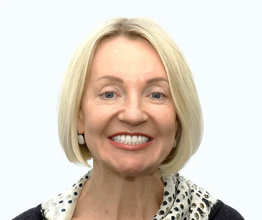 После имплантации зубов