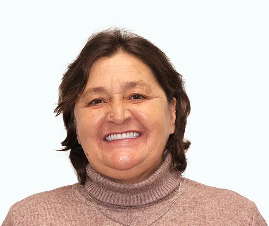 Фото: ПОСЛЕ имплантации