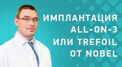 Имплантация All-on-3 или Trefoil от Nobel