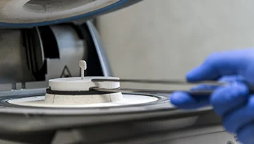 Создение зубных коронов в Smile-at-Once