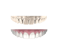Циркониевые зубные коронки