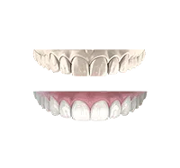 Циркониевые зубные коронки